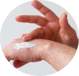 Crema para quemaduras