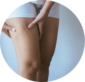 Retención de líquidos