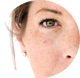 Antimanchas o despigmentantes