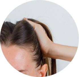 Dermatitis seborreica